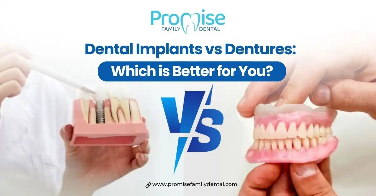 Dental Implants vs Dentures: Which is Better for You?