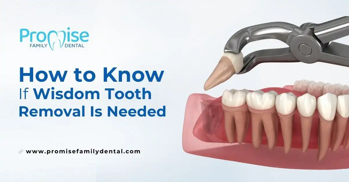 How to Know If Wisdom Tooth Removal Is Needed