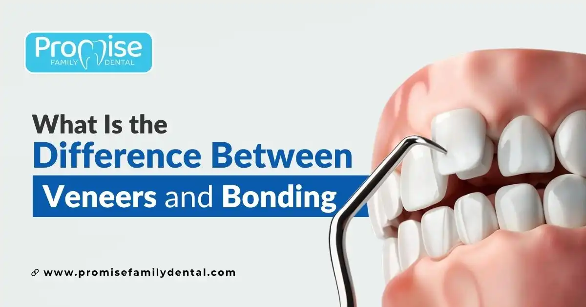 What Is the Difference Between Veneers and Bonding