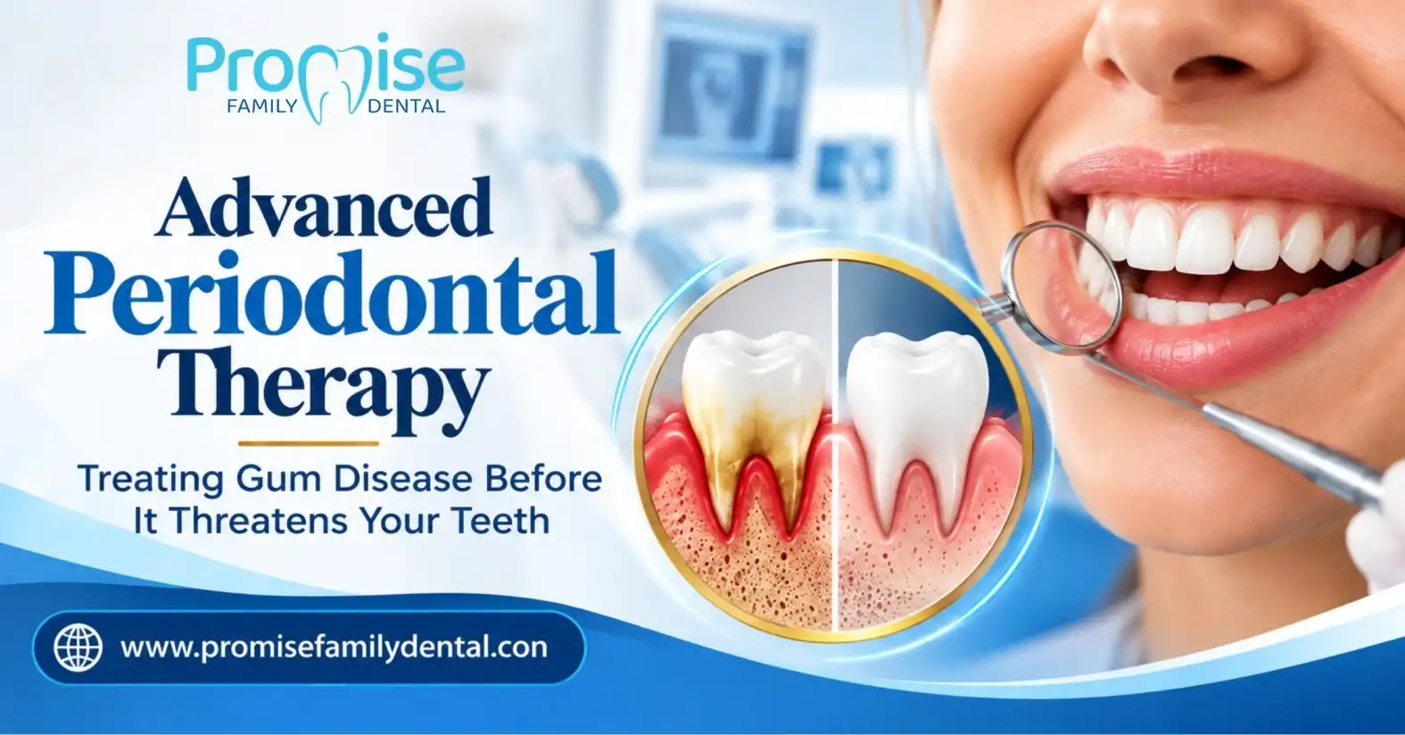 Advanced Periodontal Therapy: Treating Gum Disease Before It Threatens Your Teeth