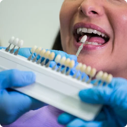 Cosmetic dentistry image